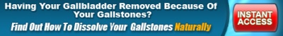 Dissolve Gallstones Naturally